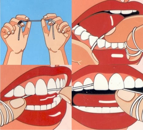 Foto de Datos acerca del uso del hilo dental